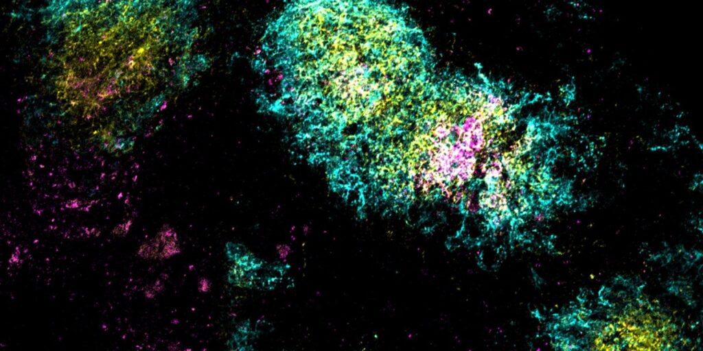 One-shot vaccines for HIV and covid