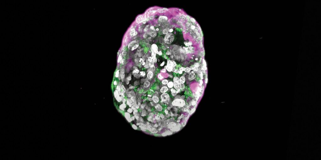 The Download: Embryo ethics, and reducing chatbot risks
